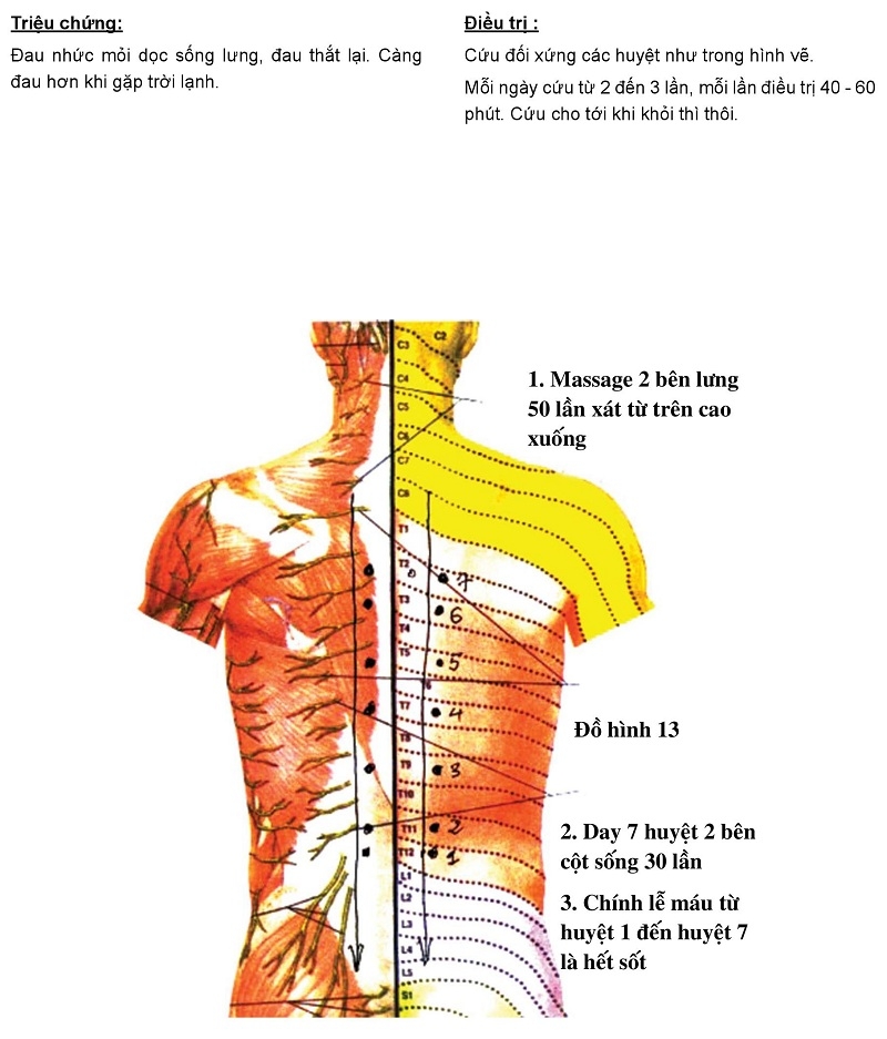 Hướng dẫn cứu ngải chữa đau lưng, đau cột sống bằng Máy cứu ngải