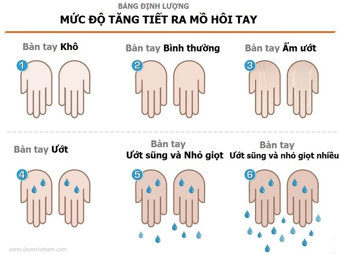 Bạn có thể nhận biết mức độ tăng tiết ra mồ hôi tay của mình dựa trên bảng định lượng trên